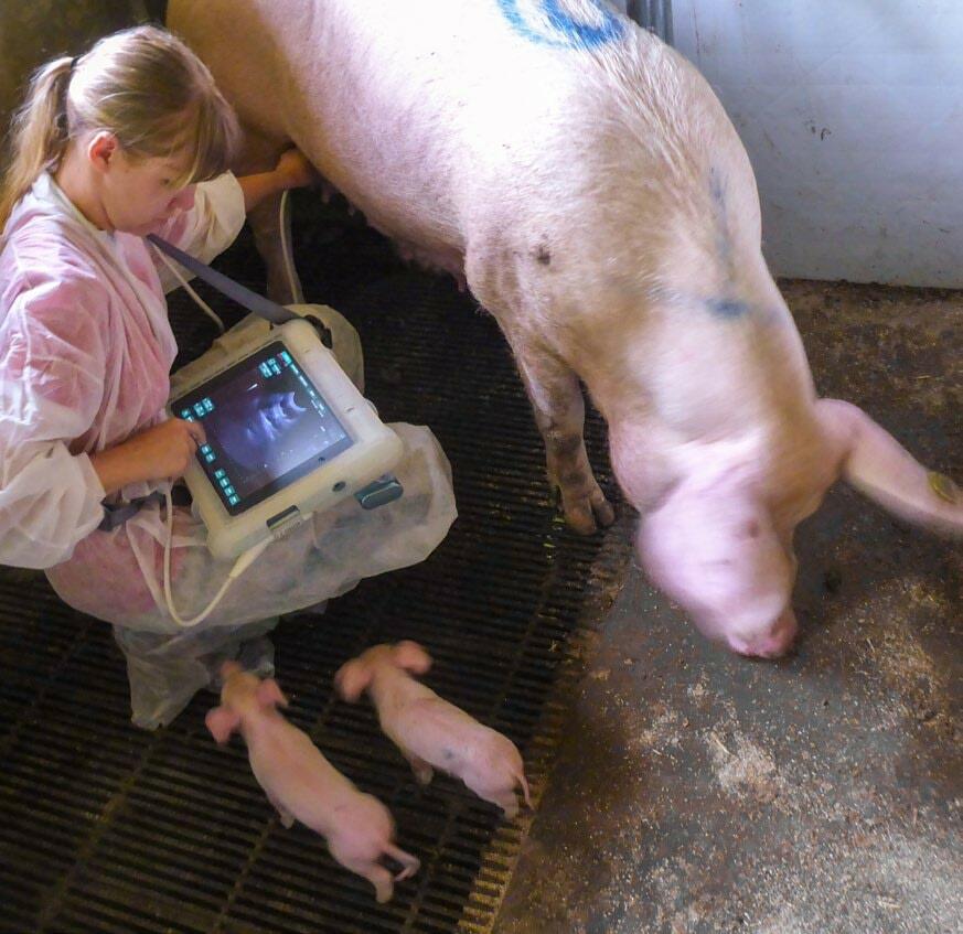 Analyse de l’utérus à l’aide de l’ultrason.